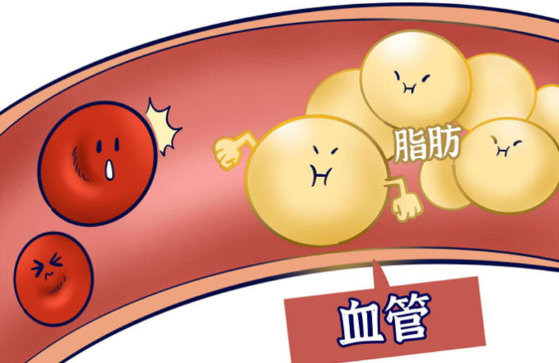 别让血脂“拖垮”你的血管！这篇科普讲透了